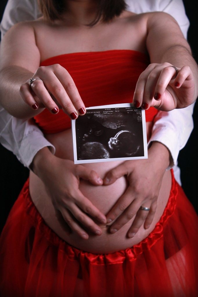 pregnancy, ultrasound, pregnant-3590794.jpg